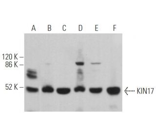 KIN17 Antibody (K58) - Western Blotting - Image 362000 