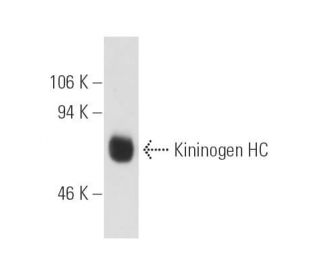 Kininogen HC Antibody (2B5) - Western Blotting - Image 6216 