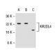 KIR2DL4 Antibody (2H6) - Western Blotting - Image 47921