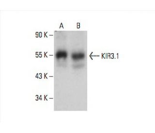 KIR3.1 Antibody (A-4) - Western Blotting - Image 392978 