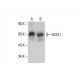 KIR3.1 Antibody (A-4) - Western Blotting - Image 392978 