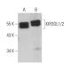 KIR3DL1/2 Antibody (G-4) - Western Blotting - Image 367615