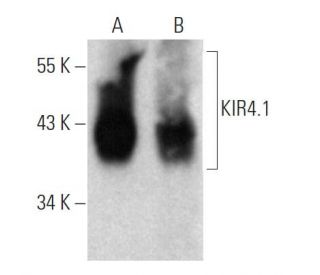 KIR4.1 Antibody (1C11) - Western Blotting - Image 367987 