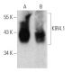KIR4.1 Antibody (1C11) - Western Blotting - Image 367987 