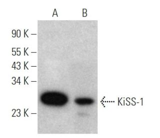KiSS-1 Antibody (24-Q) - Western Blotting - Image 367988The Double Nickase Plasmid features a U6 promoter for sgRNA expression, a 20 nt targeting sequence, and a gRNA scaffold to guide Cas9n. It includes a CBh promoter for Cas9n (D10A) and puromycin resistance, GFP for transfection verification, and nuclear localization signals (NLS). The 2A peptide allows co-expression of Cas9n and Puro from a single promoter, enabling precise genome editing with reduced off-target effects.