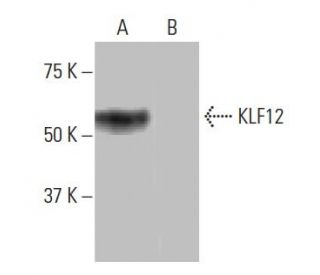 KLF12 Antibody (NQ-C45) - Western Blotting - Image 64984SAM Transcription Activation: SAM system utilizing dCas9-VP64, MS2-P65-HSF1, and sgRNA for precise gene transcription activation.