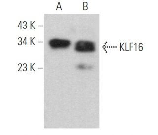 KLF16 Antibody (F-4) - Western Blotting - Image 369351 
