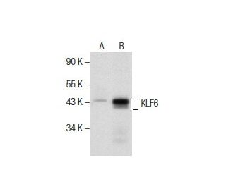 KLF6 Antibody (E-10) - Western Blotting - Image 157488Each CRISPR/Cas9 Knockout (KO) Plasmid product consists of a pool of 3 plasmids designed to ensure identification and cleavage of a specific gene for maximum knockout efficiency. Each plasmid encodes a unique 20 nt sequence derived from the GeCKO (v2) library.