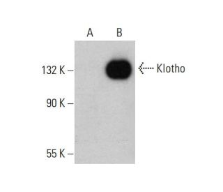 Klotho Antibody (F-5) - Western Blotting - Image 384255 