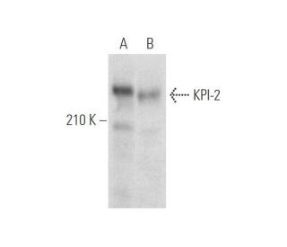 KPI-2 Antibody (H-9) - Western Blotting - Image 316280