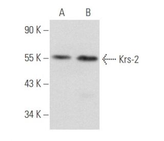 Krs-2 Antibody (H-8) - Western Blotting - Image 357688