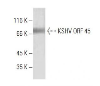 KSHV ORF 45 Antibody (2D4A5) - Western Blotting - Image 137439