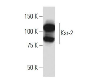 Ksr-2 Antibody (K75) - Western Blotting - Image 33794 
