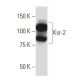Ksr-2 Antibody (K75) - Western Blotting - Image 33794 