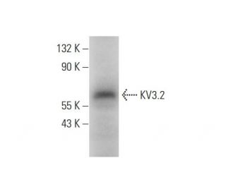 KV3.2 Antibody (H-11) - Western Blotting - Image 314099