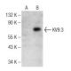 KV9.3 Antibody (D-11) - Western Blotting - Image 141724