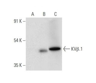 KVβ Antibody (H-5) - Western Blotting - Image 309630