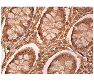 L-FABP Antibody (C-4) - Immunohistochemistry - Image 160219 