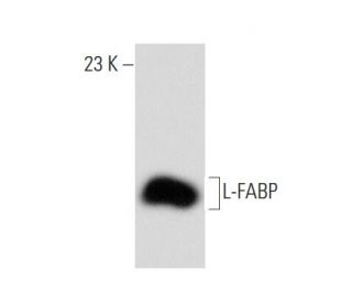 L-FABP Antibody (F-9) - Western Blotting - Image 134759 