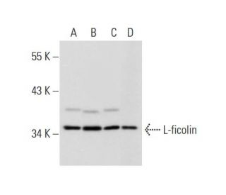 L-ficolin Antibody (005-19-1) - Western Blotting - Image 324623 