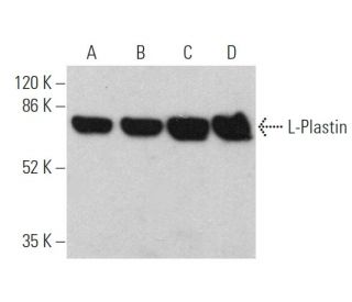 L-Plastin Antibody (B-9) - Western Blotting - Image 360327