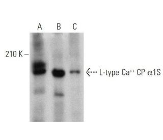 L-type Ca<sup>++</sup> CP &alpha;1S Antibody (G-1) - Western Blotting - Image 359460 