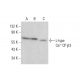 L-type Ca++ CP β3 Antibody (7D1) - Western Blotting - Image 382089
