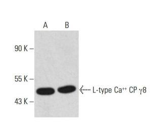 L-type Ca<sup>++</sup> CP &gamma;8 Antibody (A-8) - Western Blotting - Image 320457