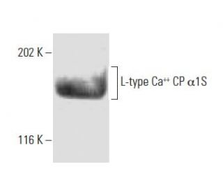L-type Ca<sup>++</sup> CP &alpha;1S Antibody (IIF71VH3) - Western Blotting - Image 9216