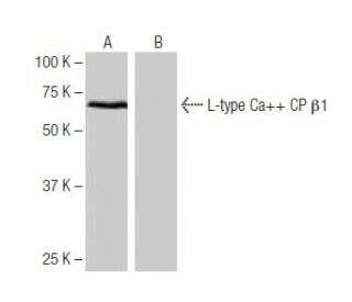 L-type Ca<sup>++</sup> CP &beta;1 Antibody (Y-2D68) - Western Blotting - Image 64988 