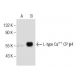 L-type Ca++ CP β4 Antibody (H-7) - Western Blotting - Image 155616