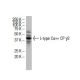 L-type Ca++ CP γ3 Antibody (A-07) - Western Blotting - Image 33539 