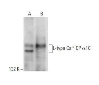 L-type Ca<sup>++</sup> CP α1C Antibody (D-6) - Western Blotting - Image 304477SAM Transcription Activation: SAM system utilizing dCas9-VP64, MS2-P65-HSF1, and sgRNA for precise gene transcription activation.