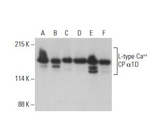 L-type Ca<sup>++</sup> CP &alpha;1D Antibody (E-3) - Western Blotting - Image 395707 