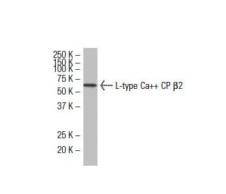 L-type Ca<sup>++</sup> CP &beta;2 Antibody (F-29) - Western Blotting - Image 33540The Double Nickase Plasmid features a U6 promoter for sgRNA expression, a 20 nt targeting sequence, and a gRNA scaffold to guide Cas9n. It includes a CBh promoter for Cas9n (D10A) and puromycin resistance, GFP for transfection verification, and nuclear localization signals (NLS). The 2A peptide allows co-expression of Cas9n and Puro from a single promoter, enabling precise genome editing with reduced off-target effects. 