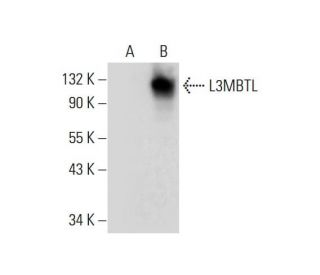 L3MBTL Antibody (D-10) - Western Blotting - Image 306563 