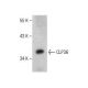 CLP36 (H-137): sc-98686. Western blot analysis of CLP36 expression in L6 whole cell lysate.