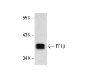 L8 Cell Lysate: sc-3807. Western blot analysis of PP1 beta expression... 