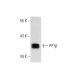 L8 Cell Lysate: sc-3807. Western blot analysis of PP1 beta expression... 