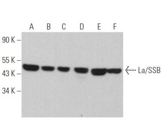 La/SSB Antibody (312B) - Western Blotting - Image 368316 