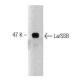 La/SSB Antibody (44) - Western Blotting - Image 127519 