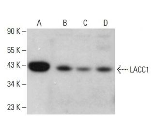 LACC1 Antibody (E-12) - Western Blotting - Image 381812 