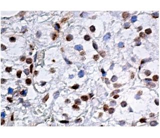 LACC1 Antibody (E-7) - Immunohistochemistry - Image 160224 