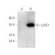 LACC1 Antibody (E-7) - Western Blotting - Image 151261 