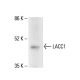 LACC1 Antibody (H-6) - Western Blotting - Image 411937