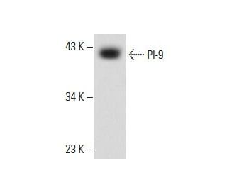 LADMAC Whole Cell Lysate: sc-364189. Western blot analysis of PI-9...