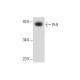 LADMAC Whole Cell Lysate: sc-364189. Western blot analysis of PI-9...