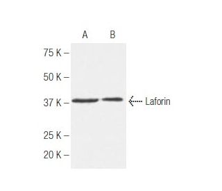 Laforin Antibody (k2A3) - Western Blotting - Image 62769