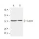 Laforin Antibody (k2A3) - Western Blotting - Image 62769