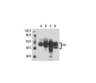 LAL Antibody (9G7F12) - Western Blotting - Image 15568 